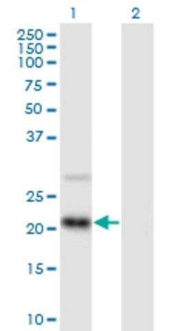 Anti-RAX2 antibody produced in mouse