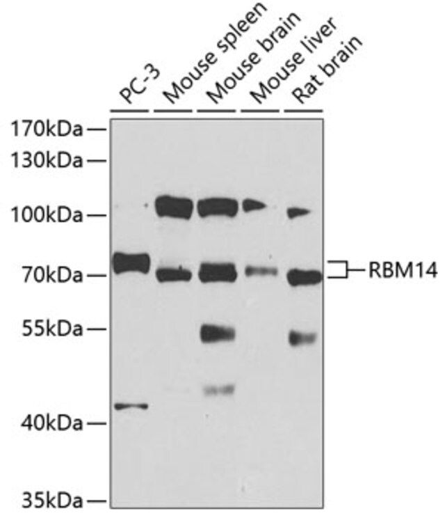 Anti-RBM14 antibody produced in rabbit