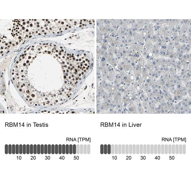 Anti-RBM14 antibody produced in rabbit