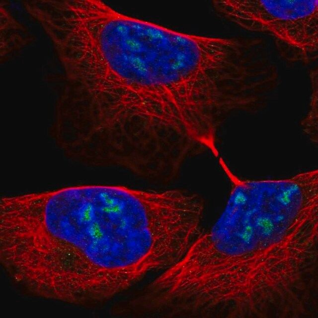 Anti-RBM28 antibody produced in rabbit