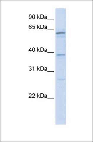 Anti-RBM39 antibody produced in rabbit