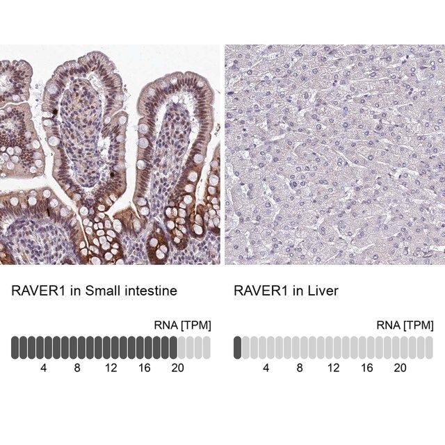 Anti-RAVER1 antibody produced in rabbit