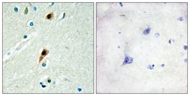 Anti-RBM5 antibody produced in rabbit