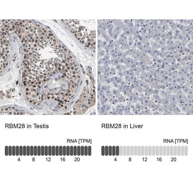 Anti-RBM28 antibody produced in rabbit