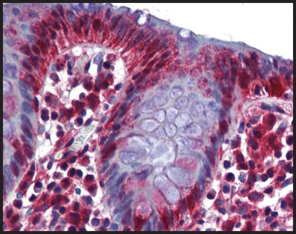 Anti-RBM47 antibody produced in rabbit