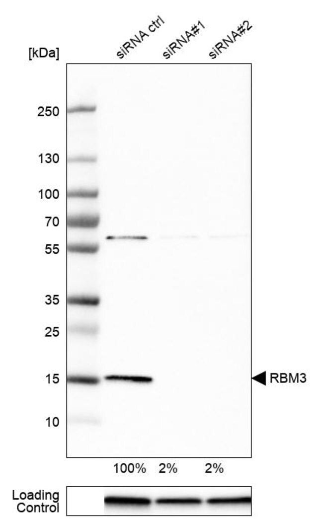 Anti-RBM3 antibody produced in rabbit