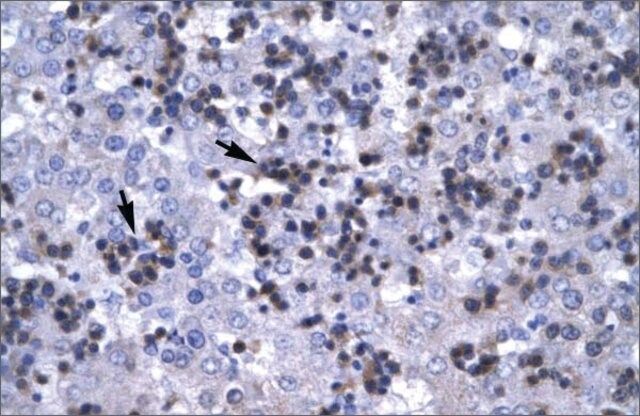 Anti-RBPJ antibody produced in rabbit