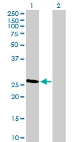 Anti-RCAN2 antibody produced in mouse