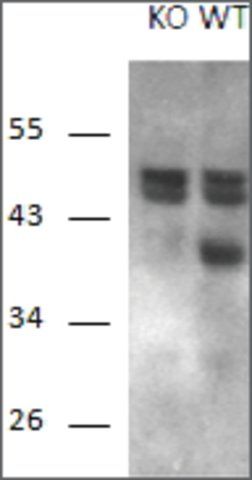 Anti-RCAN1 antibody produced in goat