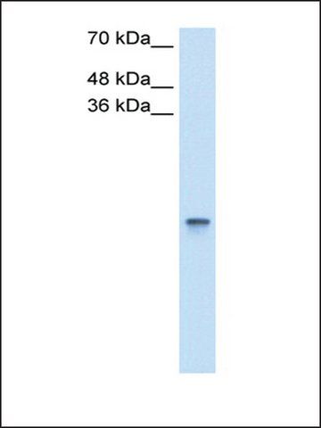 Anti-RBP1 antibody produced in rabbit