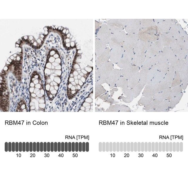 Anti-RBM47 antibody produced in rabbit