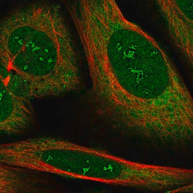 Anti-RBMS2 antibody produced in rabbit