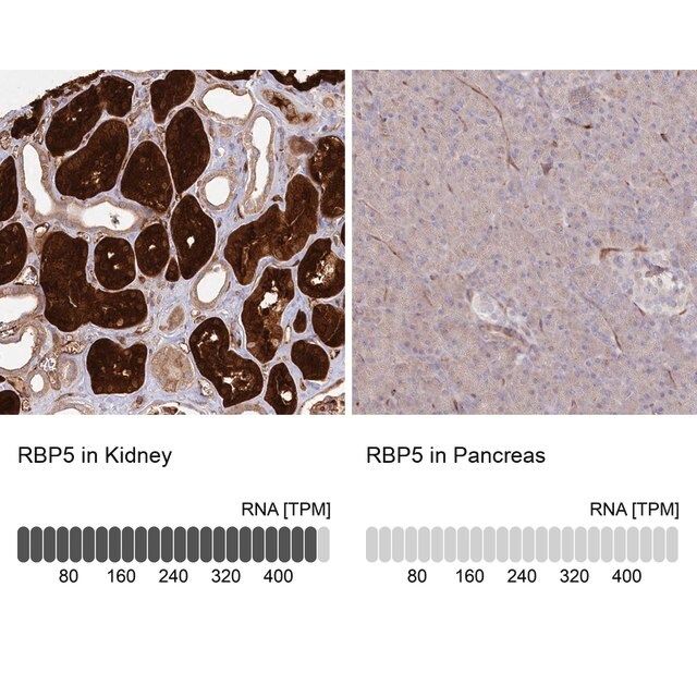 Anti-RBP5 antibody produced in rabbit