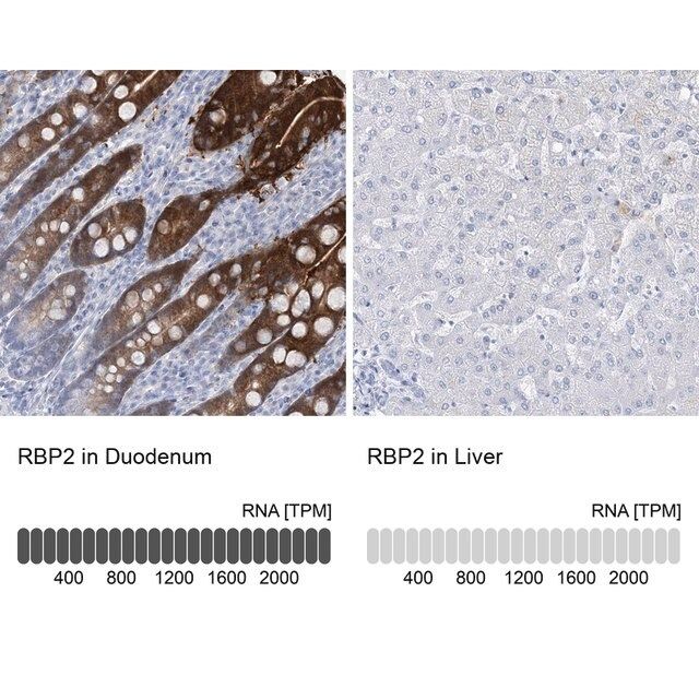 Anti-RBP2 antibody produced in rabbit