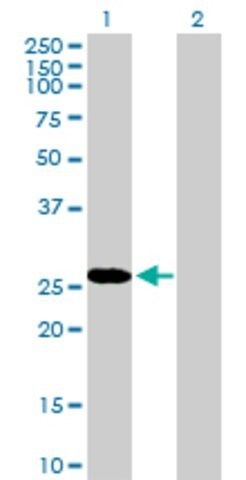 Anti-RBPMS antibody produced in mouse