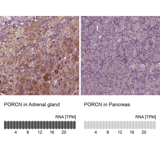 Anti-PORCN antibody produced in rabbit