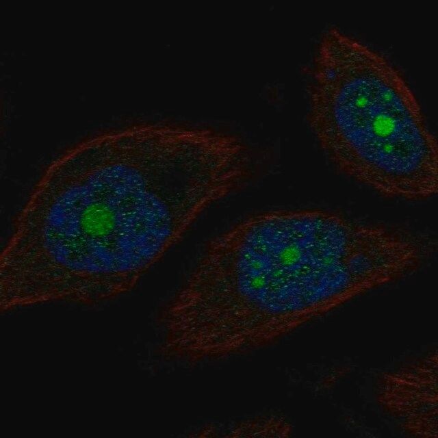 Anti-POP1 antibody produced in rabbit