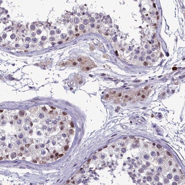 Anti-POM121L2 antibody produced in rabbit