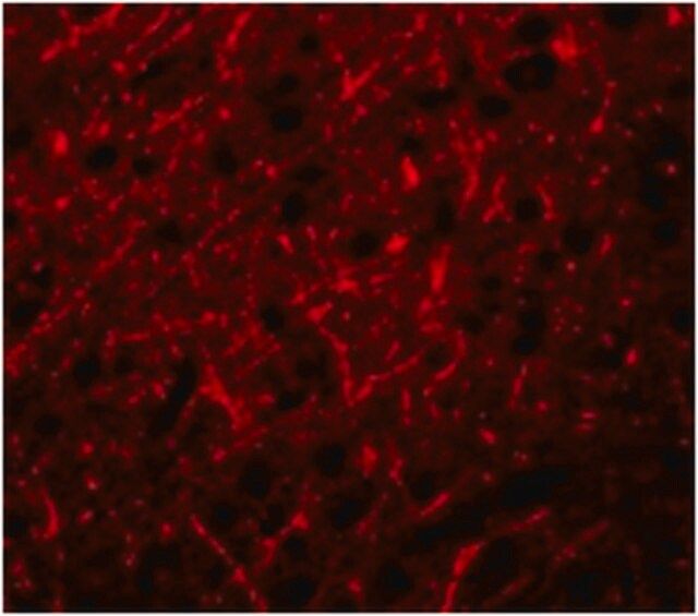 Anti-PRDM16 Antibody