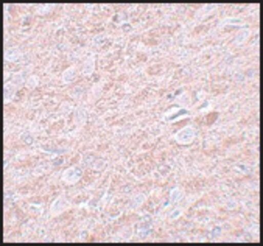 Anti-PRDM16 antibody produced in rabbit