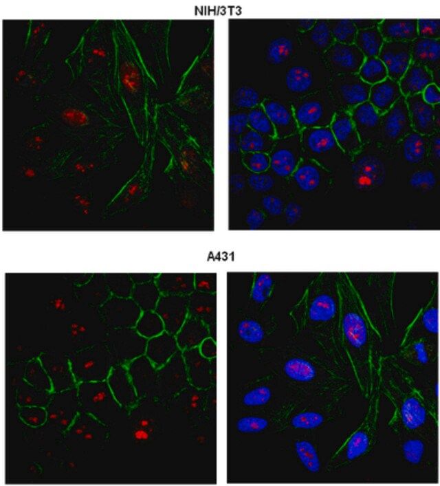 Anti-PRDM12 Antibody