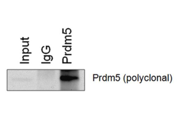 Anti-PRDM5 Antibody