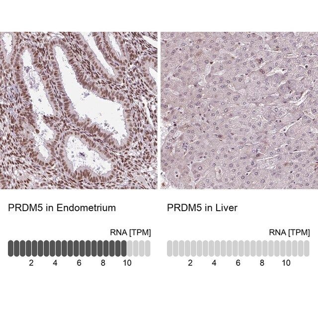 Anti-PRDM5 antibody produced in rabbit