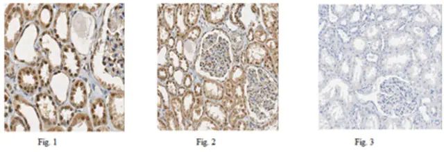 Anti-PRDM16 Antibody