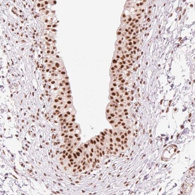 Anti-PRDM11 antibody produced in rabbit