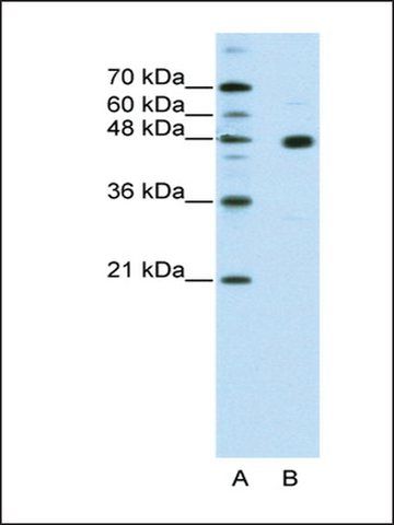 Anti-PRDM12 antibody produced in rabbit