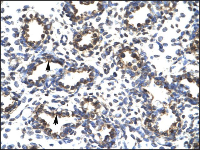 Anti-PRDM14 antibody produced in rabbit