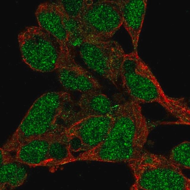 Anti-PRDM16 antibody produced in rabbit