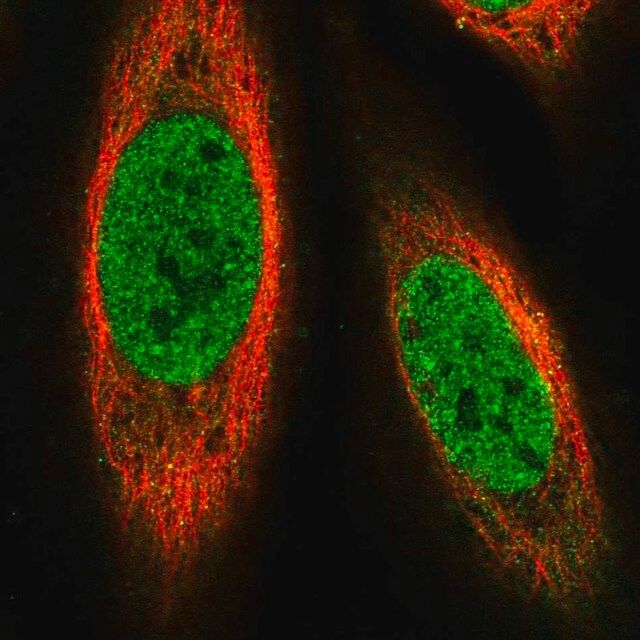 Anti-PRDM14 antibody produced in rabbit