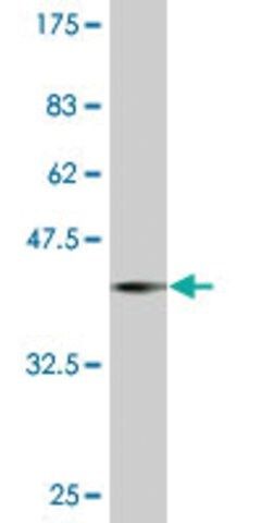 ANTI-PRDM1 antibody produced in mouse