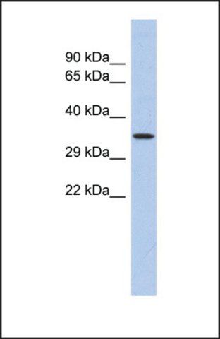 Anti-PRDM12, (N-terminal) antibody produced in rabbit