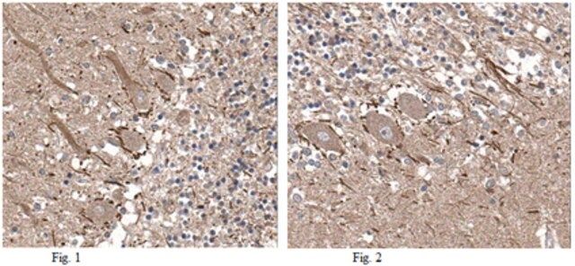 Anti-Precerebellin Antibody