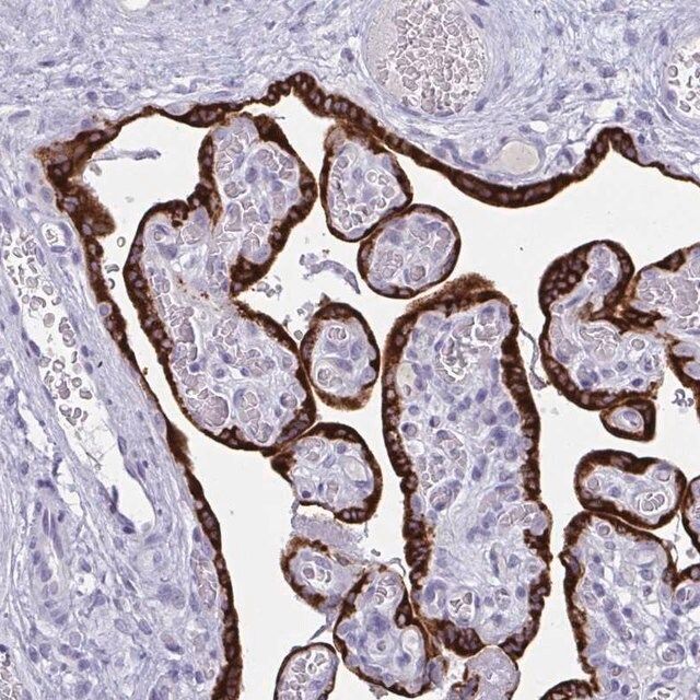 Anti-PRDM9 antibody produced in rabbit