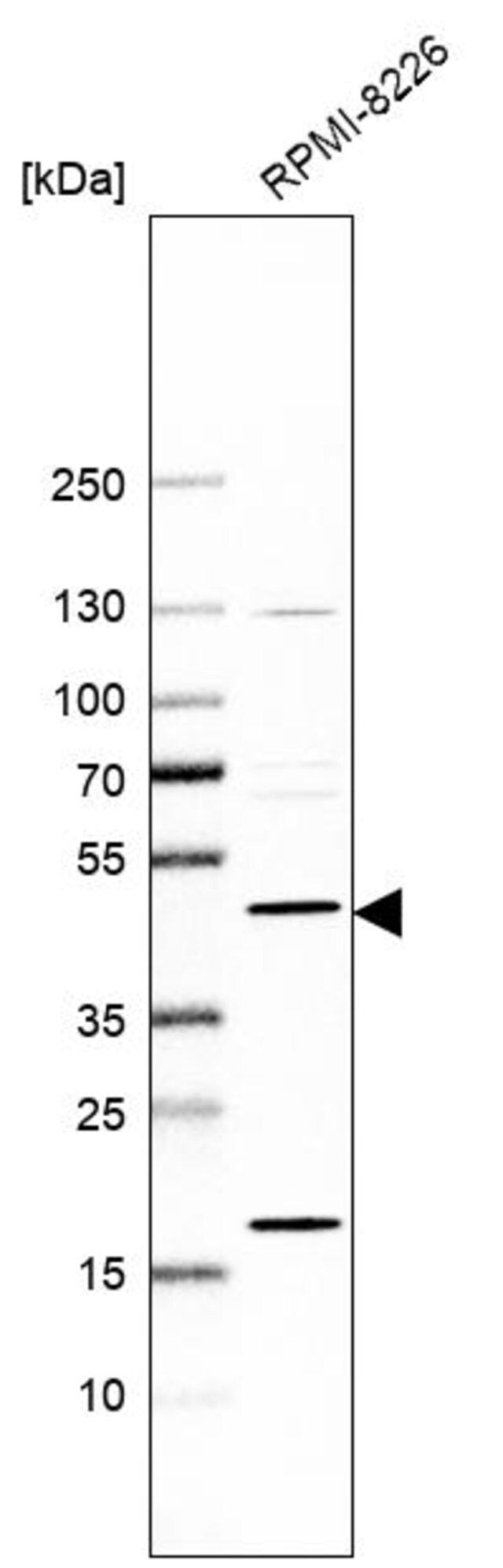 Anti-PREB antibody produced in rabbit