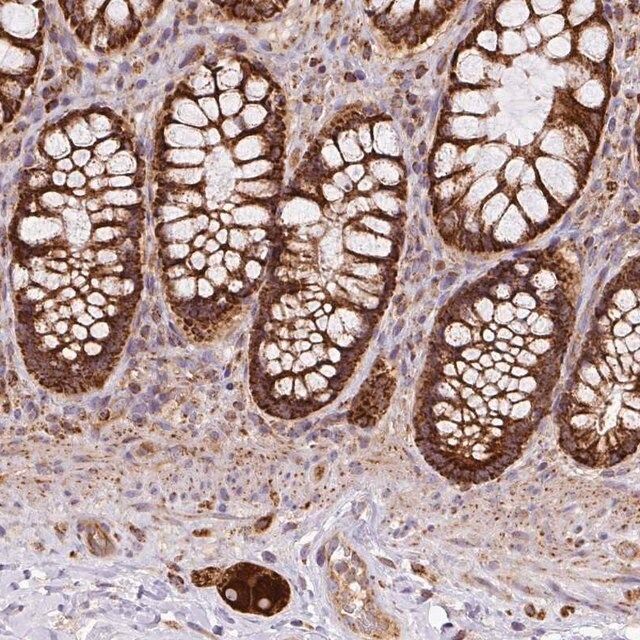 Anti-PRELID3B antibody produced in rabbit