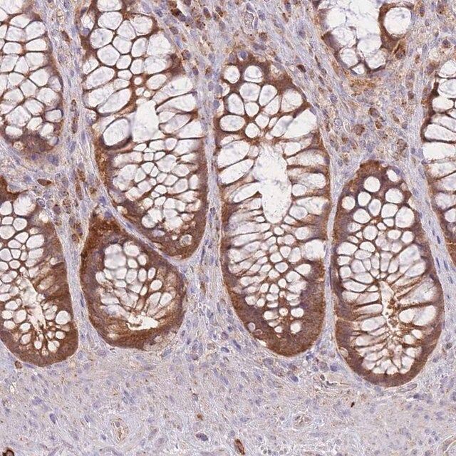 Anti-PREP antibody produced in rabbit