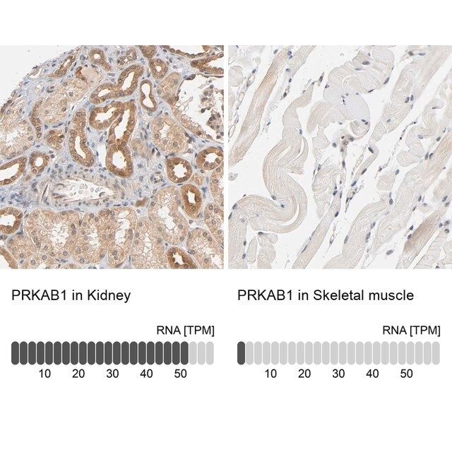 Anti-PRKAB1 antibody produced in rabbit