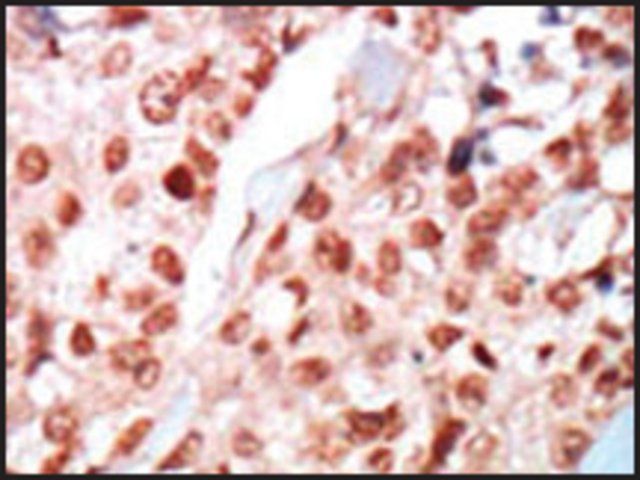 Anti-PRKAG1 (center) antibody produced in rabbit