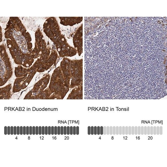 Anti-PRKAB2 antibody produced in rabbit