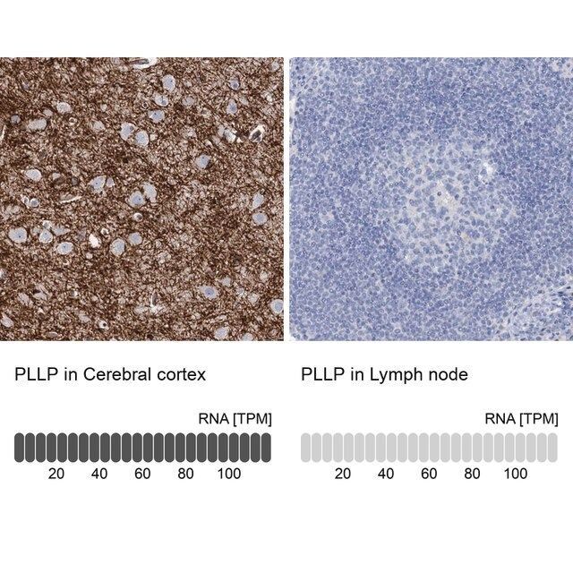 Anti-PLLP antibody produced in rabbit