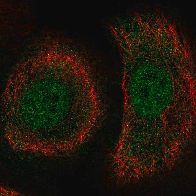 Anti-PLEKHA1 antibody produced in rabbit