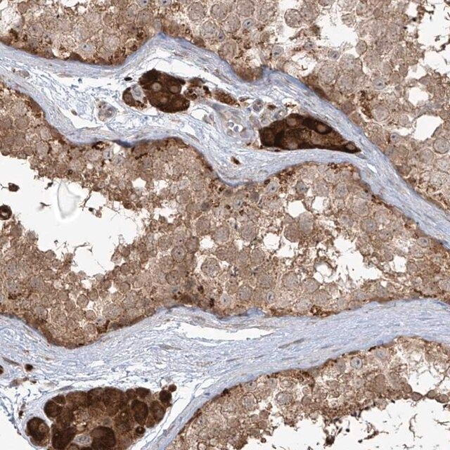 Anti-PLEKHM3 antibody produced in rabbit