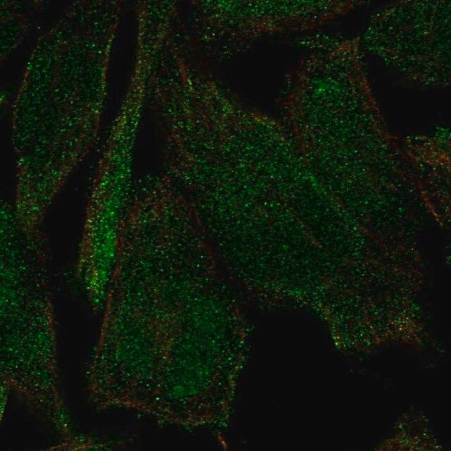 Anti-PLEKHH2 antibody produced in rabbit