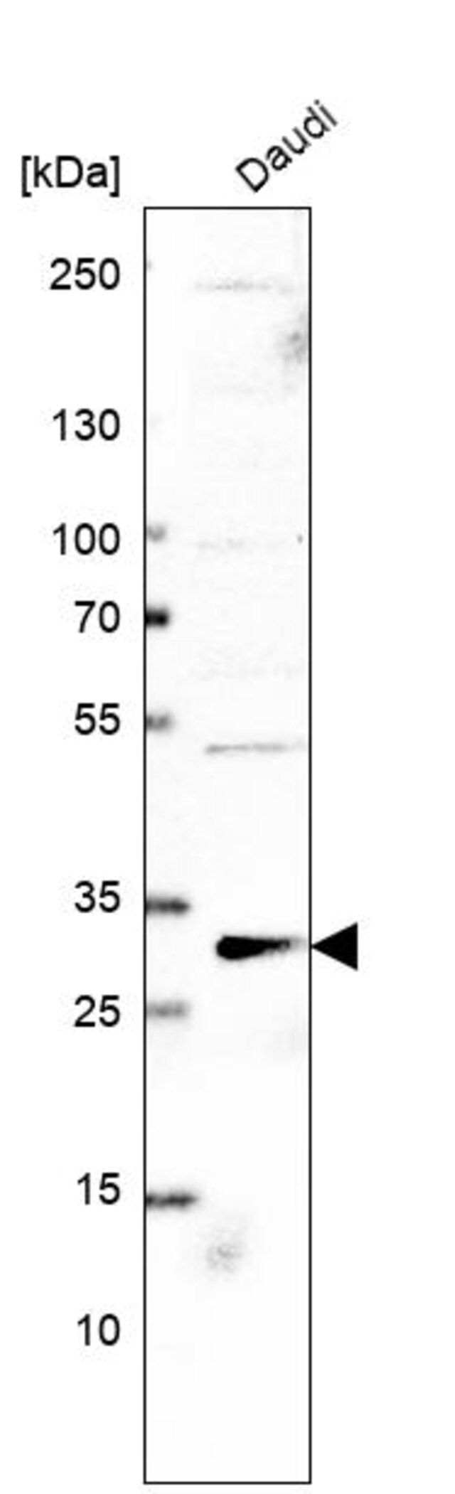 Anti-PLEKHF2 antibody produced in rabbit