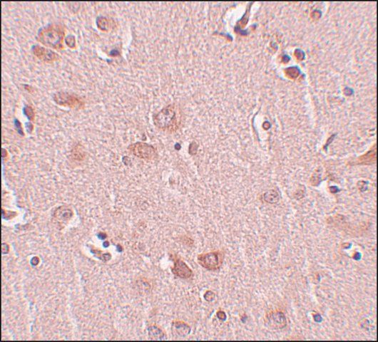 Anti-PLEKHM2 antibody produced in rabbit