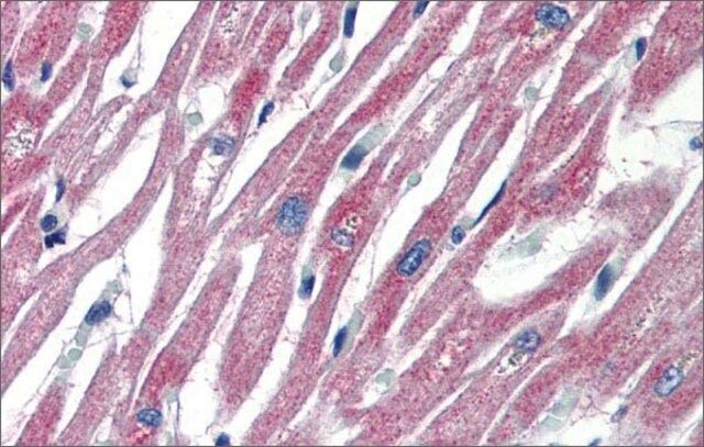 Anti-PLEKHH2 antibody produced in rabbit